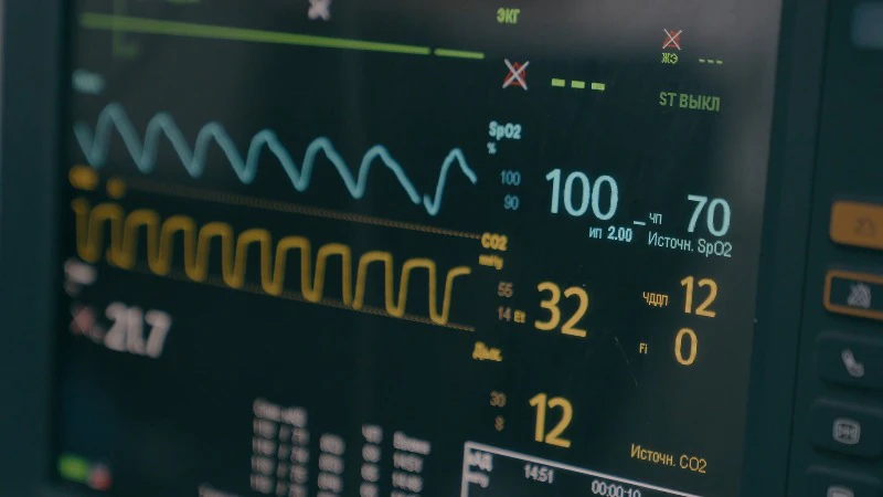Operating Room, Hospital, Surgery, Heartbeat by MayaLab – Stock Footage ...